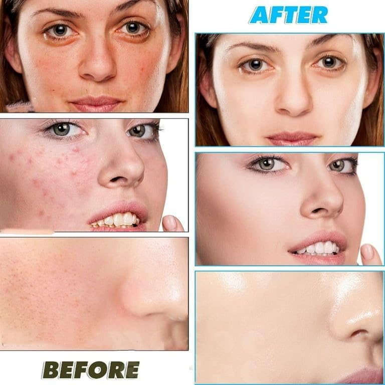 Turmeric & Kojic Acid Face Cleansing Pads